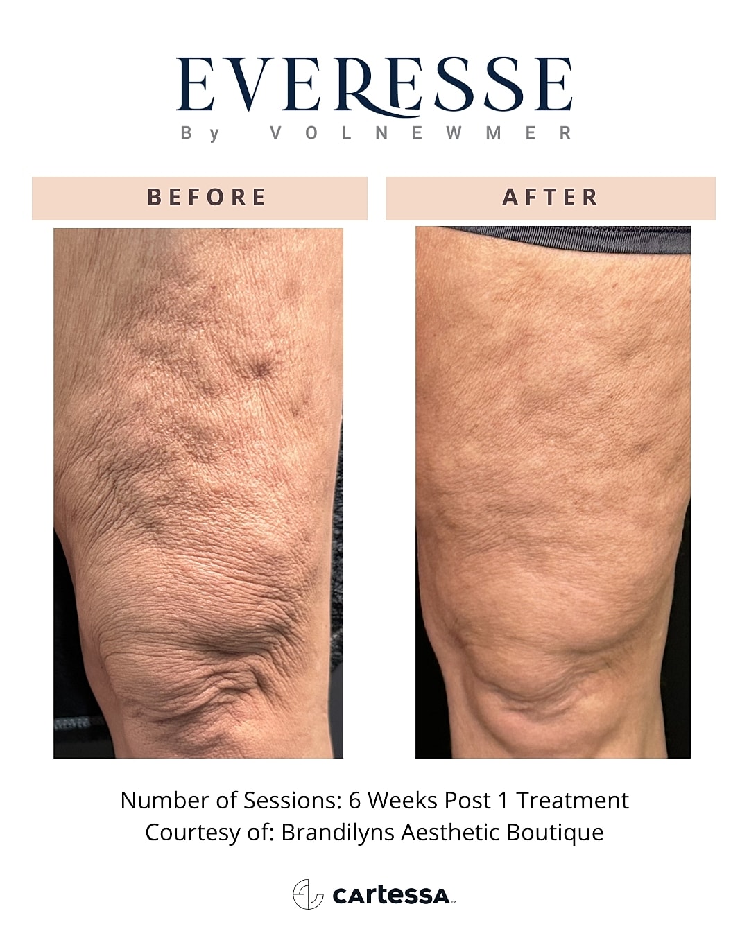 Knee treatment results before and after session.