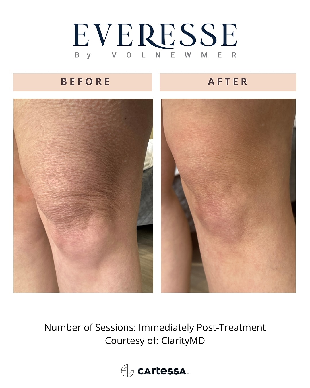 Before and after skin treatment comparison.