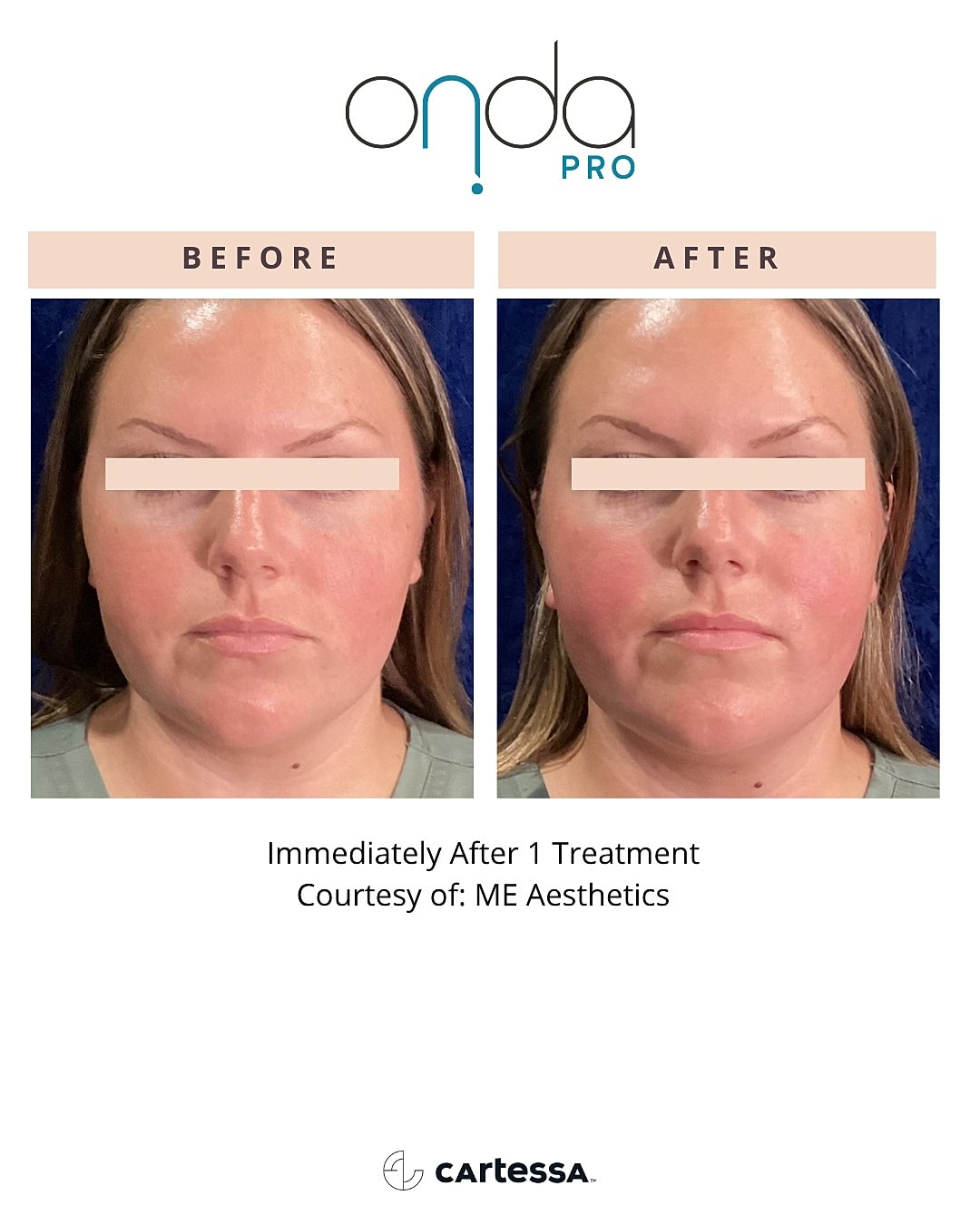Skin treatment results before and after comparison
