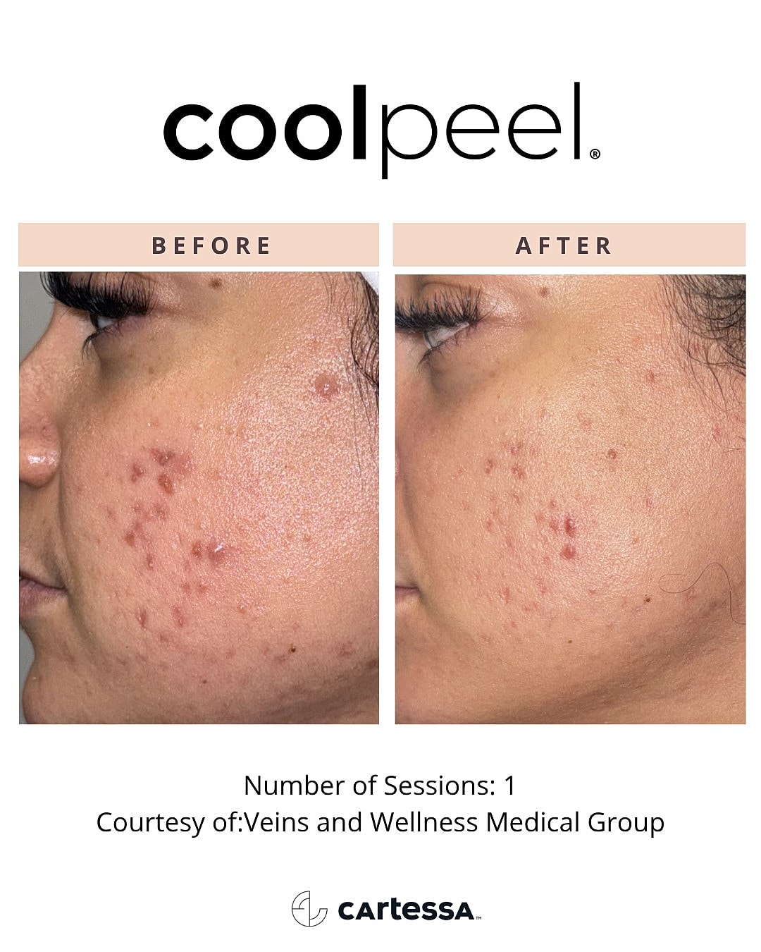 Skin treatment results: before and after comparisons
