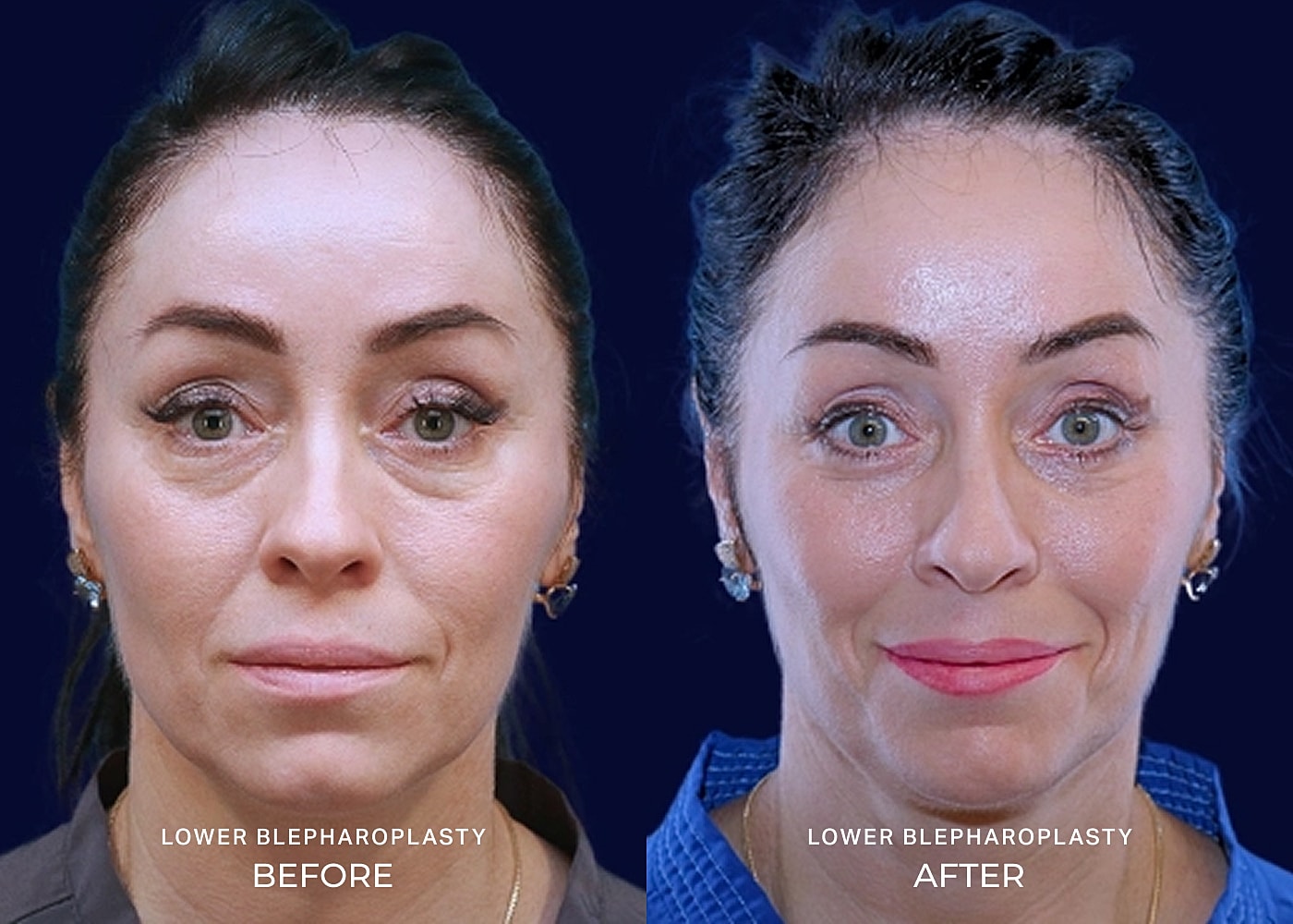 Before and after skincare treatment.