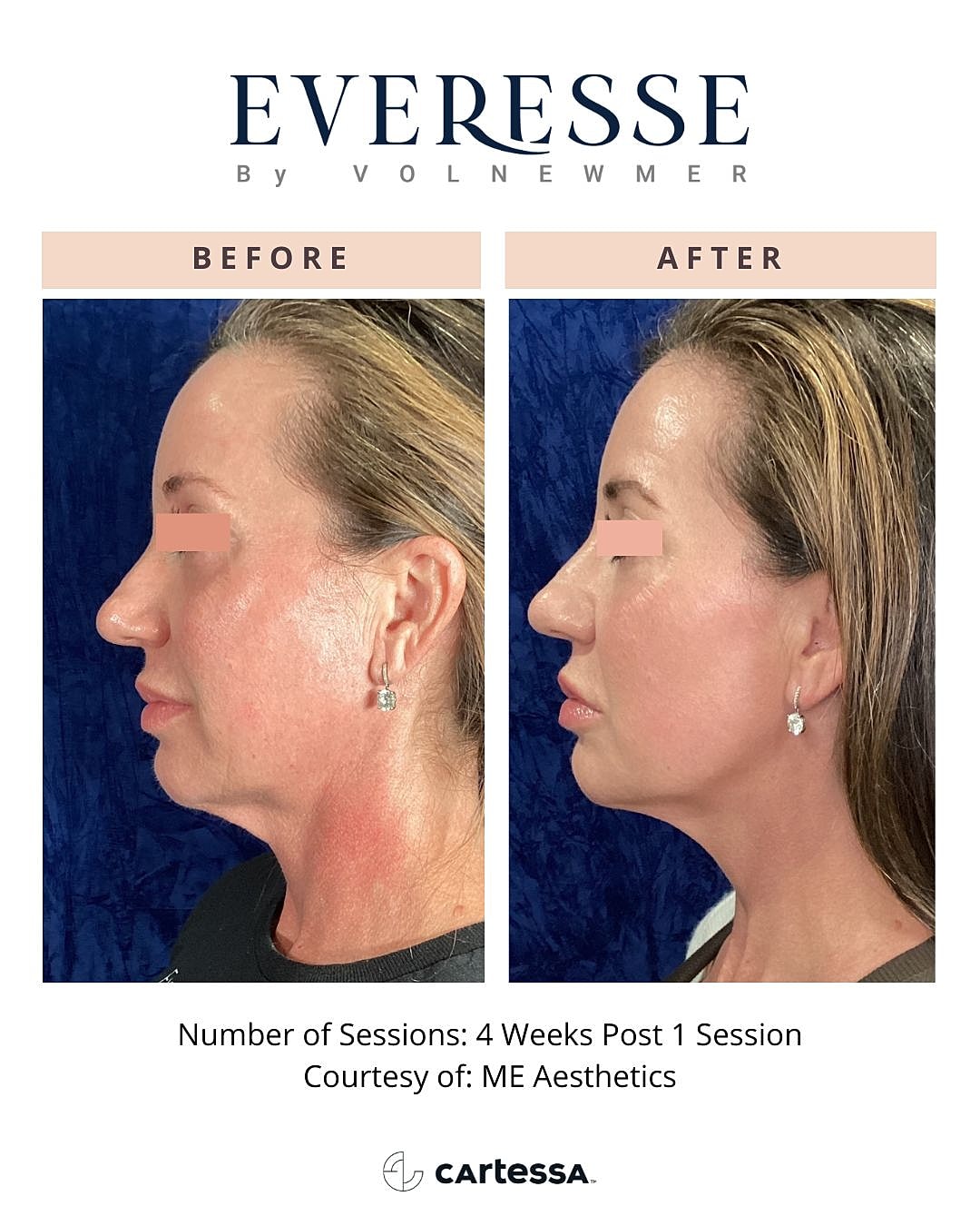 Before and after aesthetic treatment results.