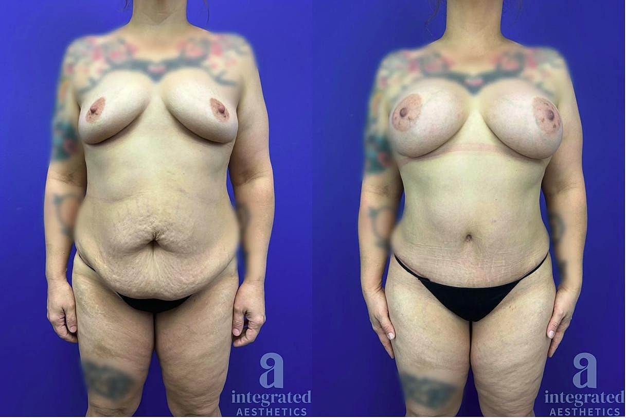 Before and after body transformation photo.