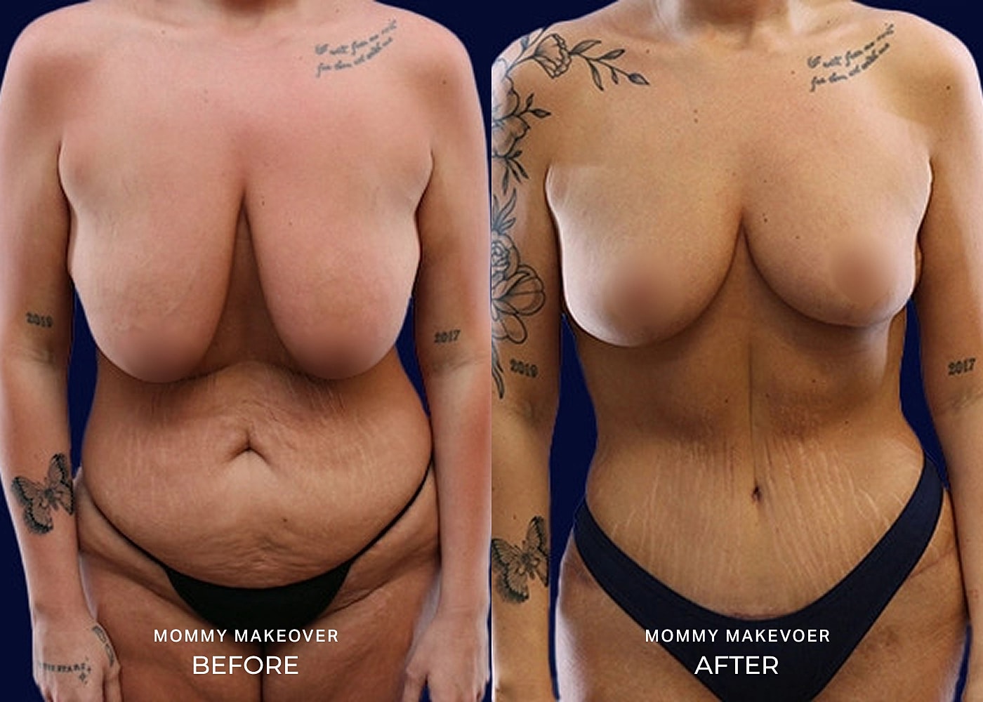 Before and after body transformation comparison image.