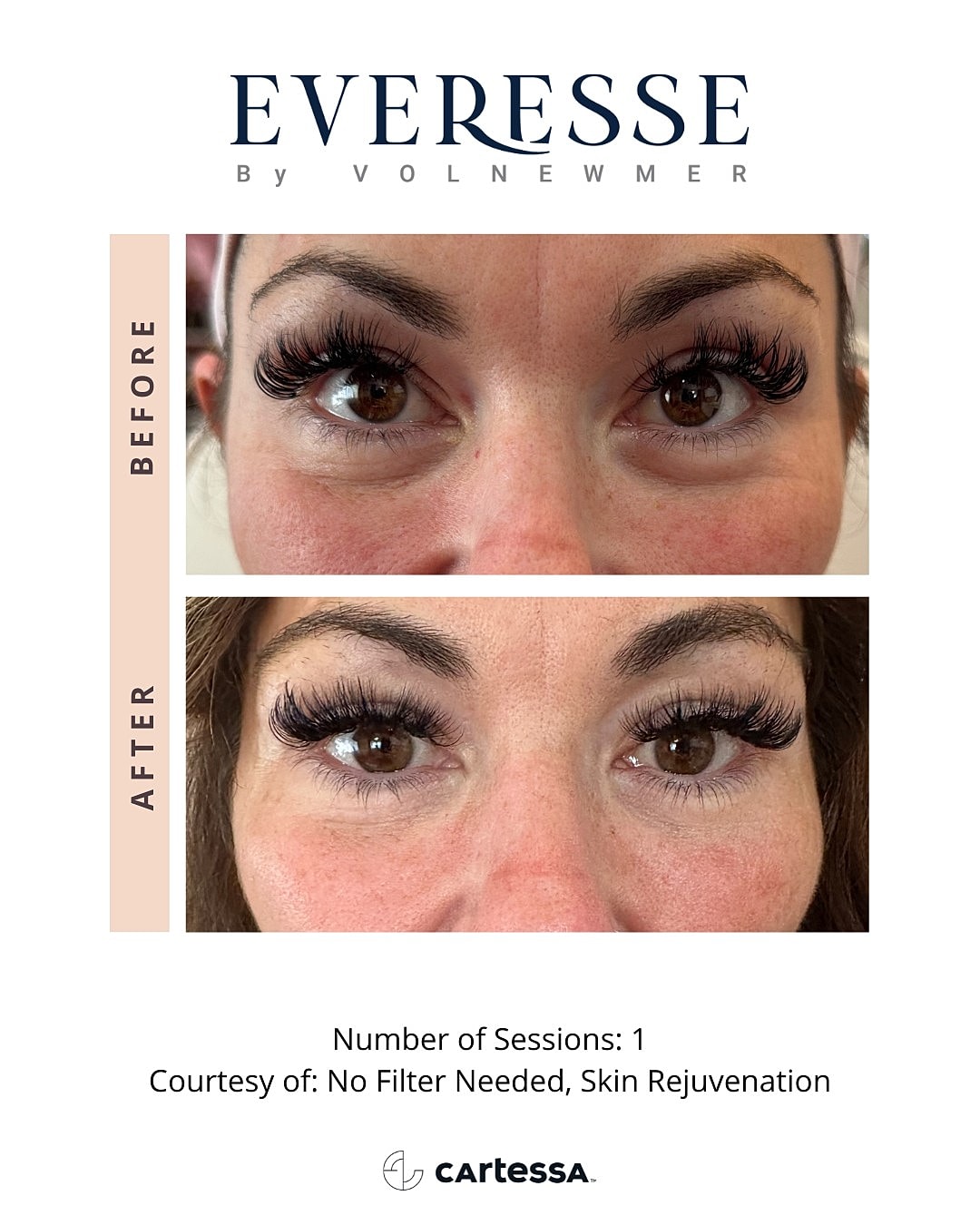 Before and after eyelash enhancement treatment results.