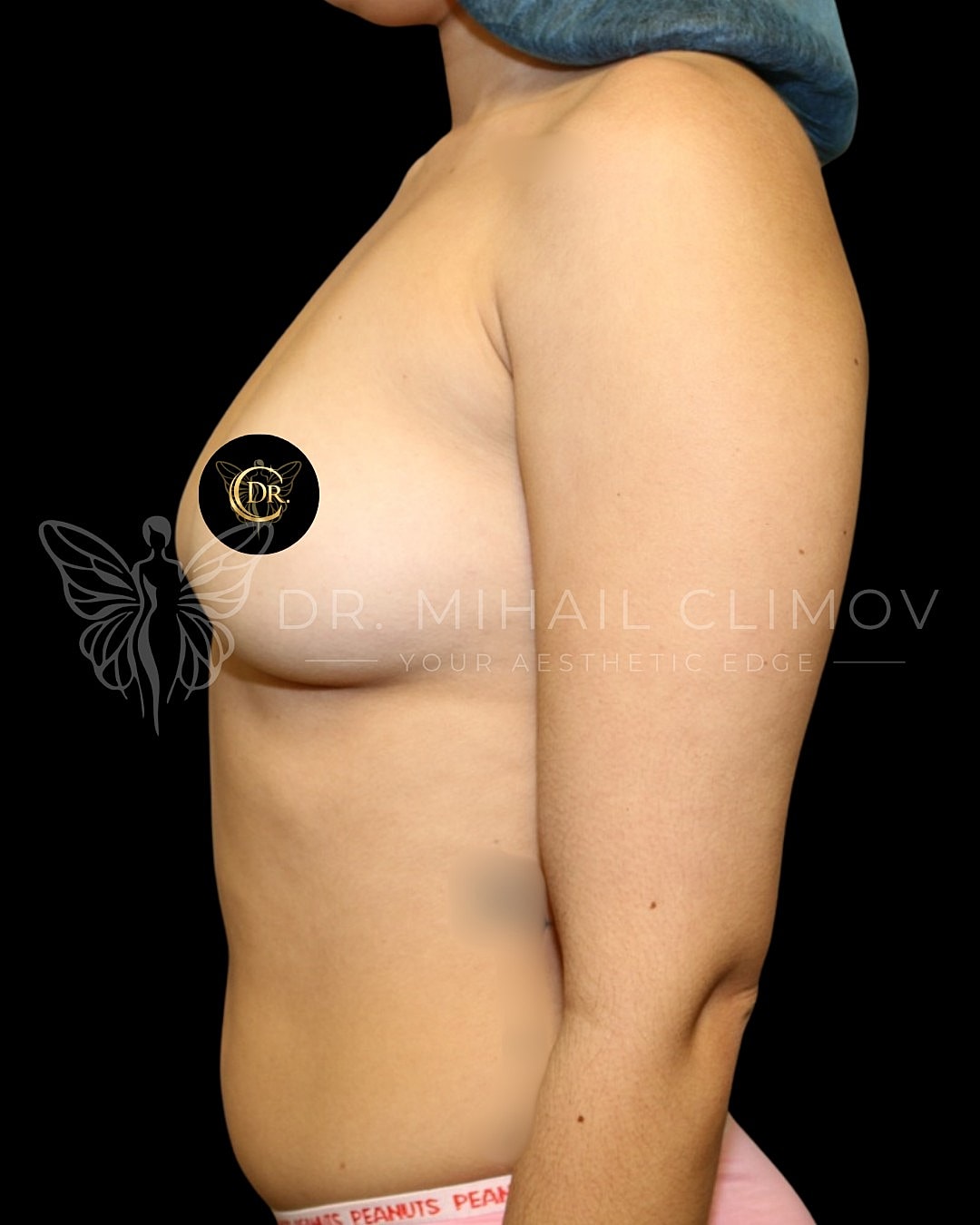 Profile view of woman's torso against black background