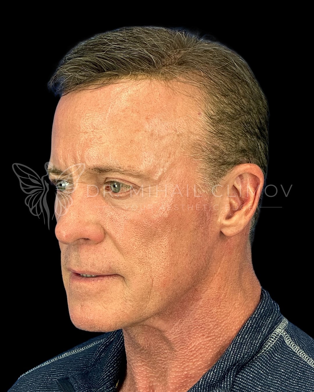 Profile of a man with short hair.