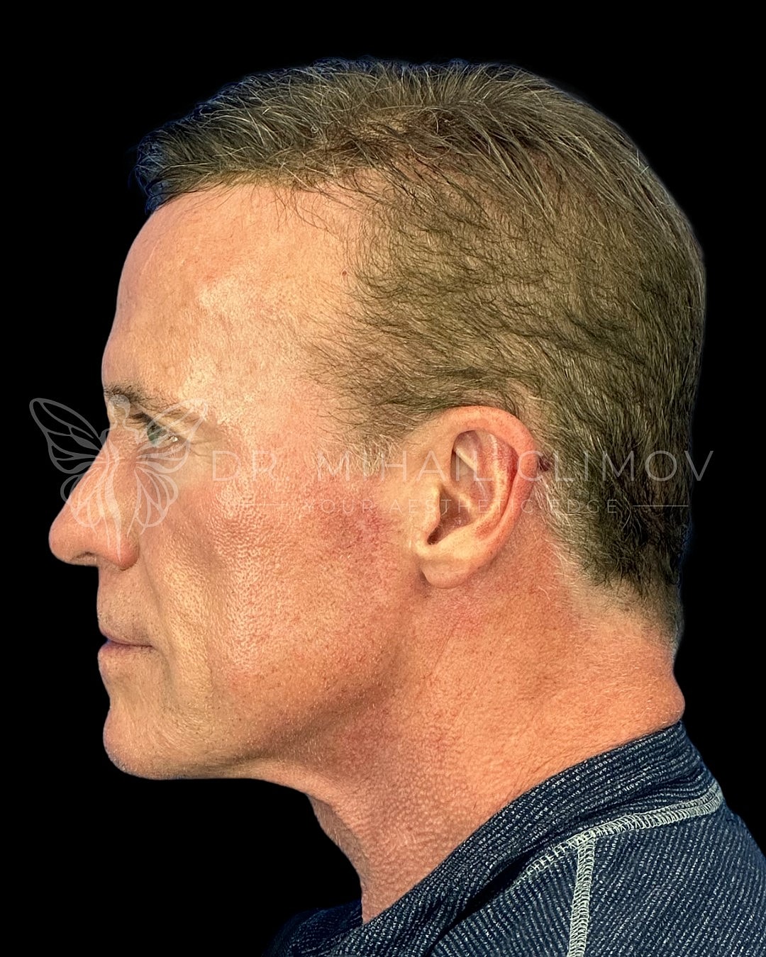 Profile of a man with short, styled hair.
