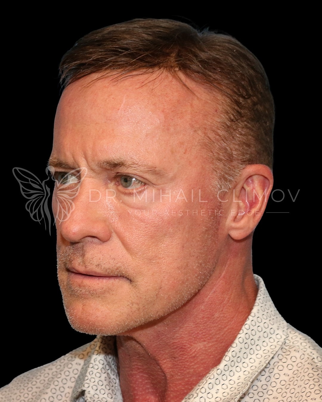 Profile view of a man with short hair.