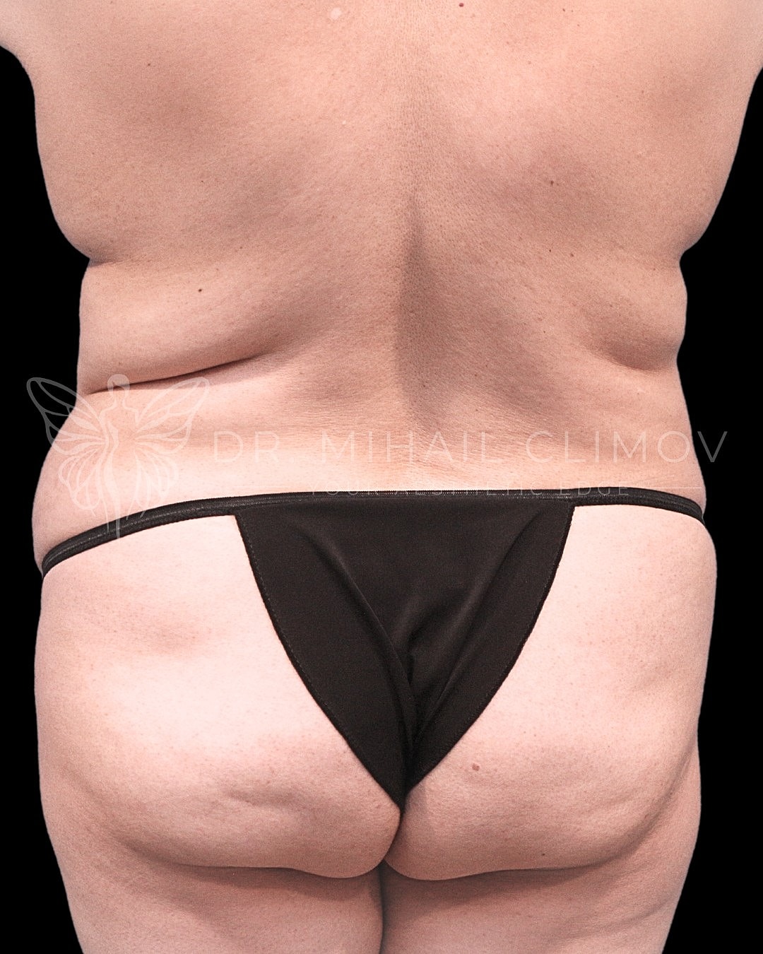 Back view of person in black thong.