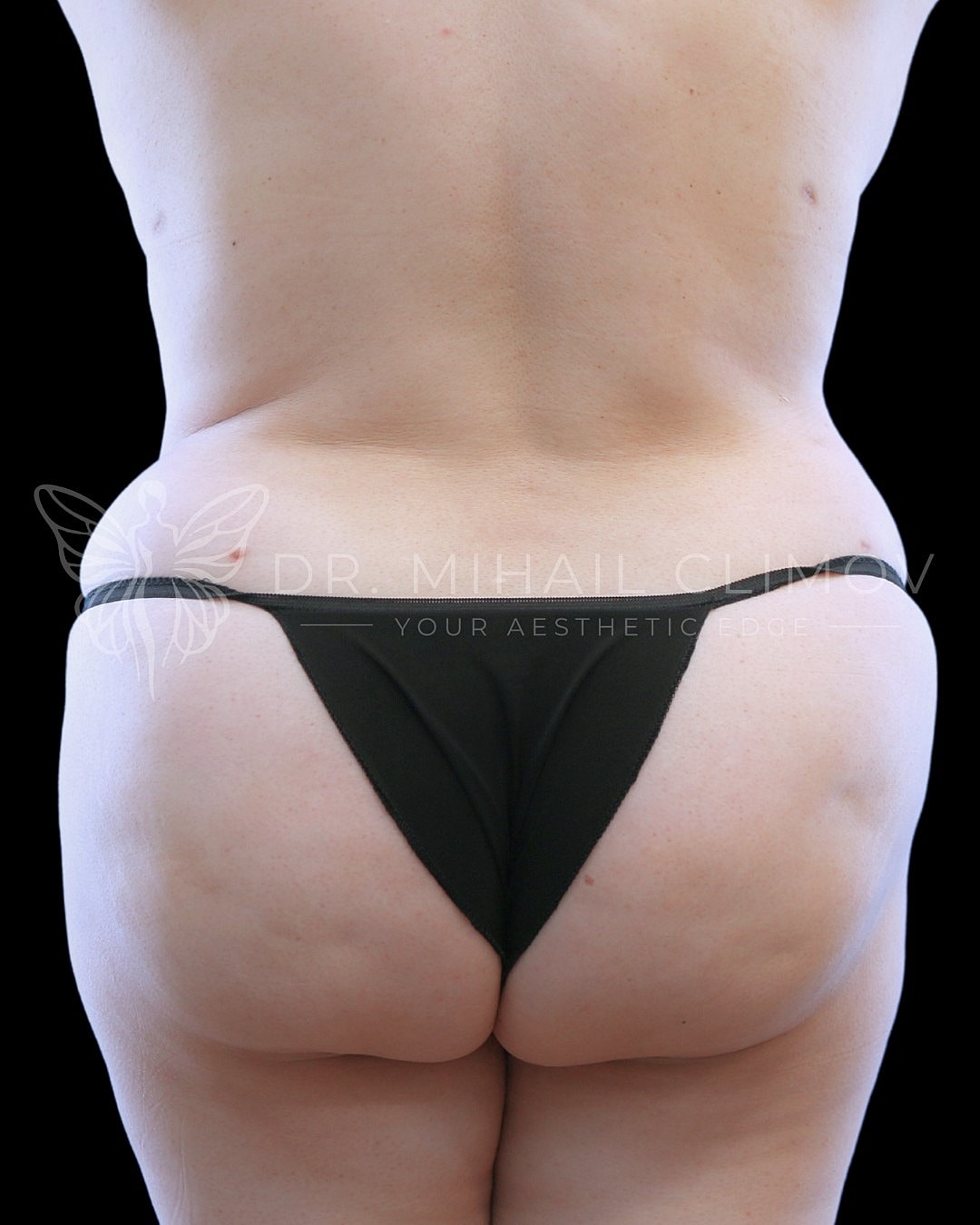 Back view of person in black thong.