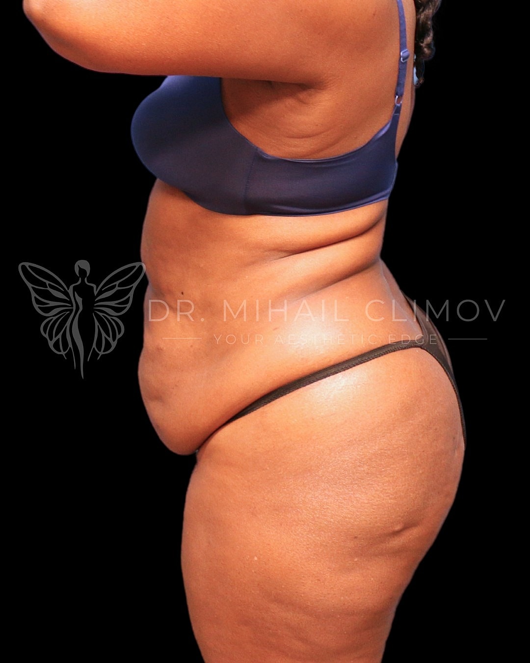 Profile view of a woman's body shape.