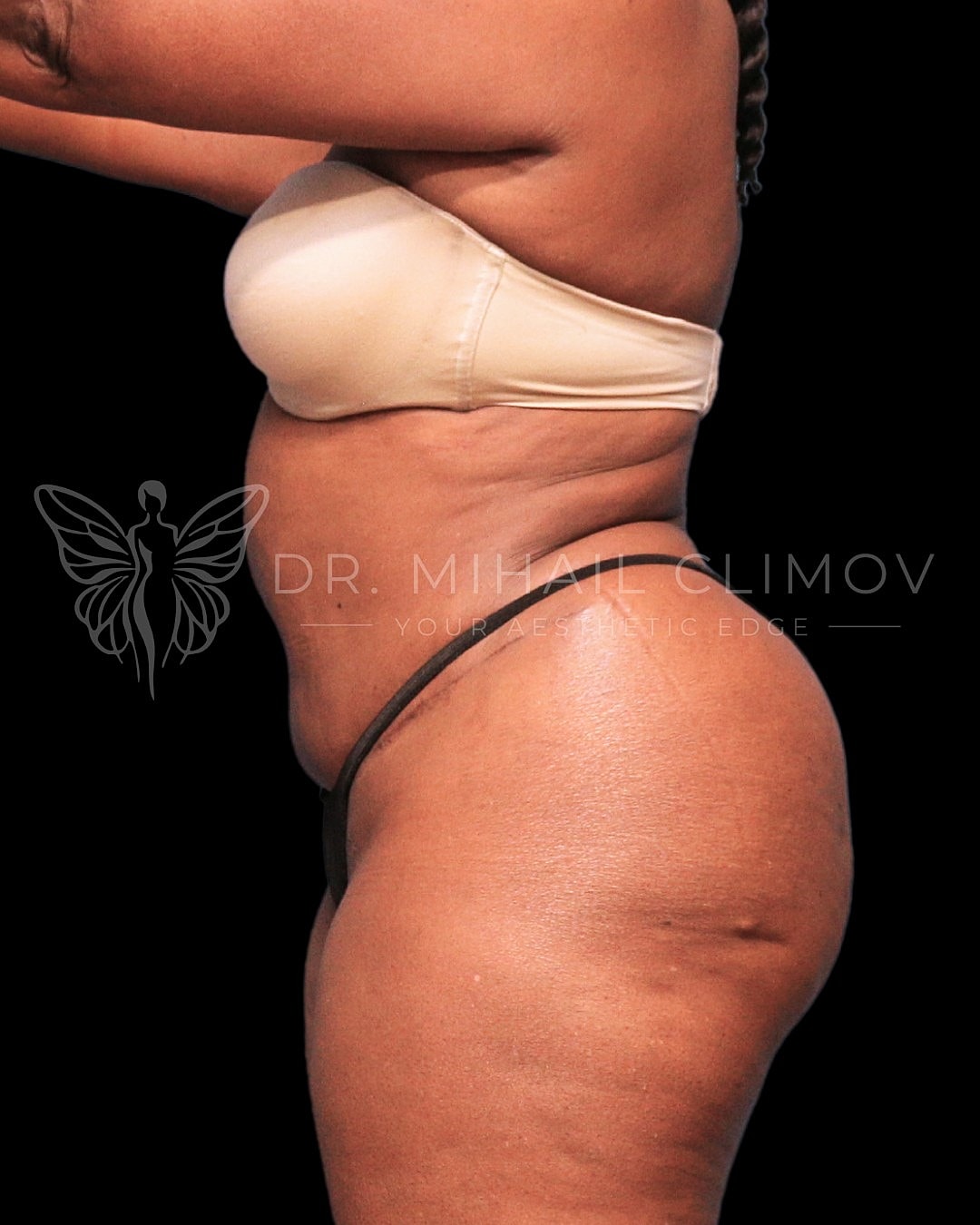 Profile view of body shape and contours.