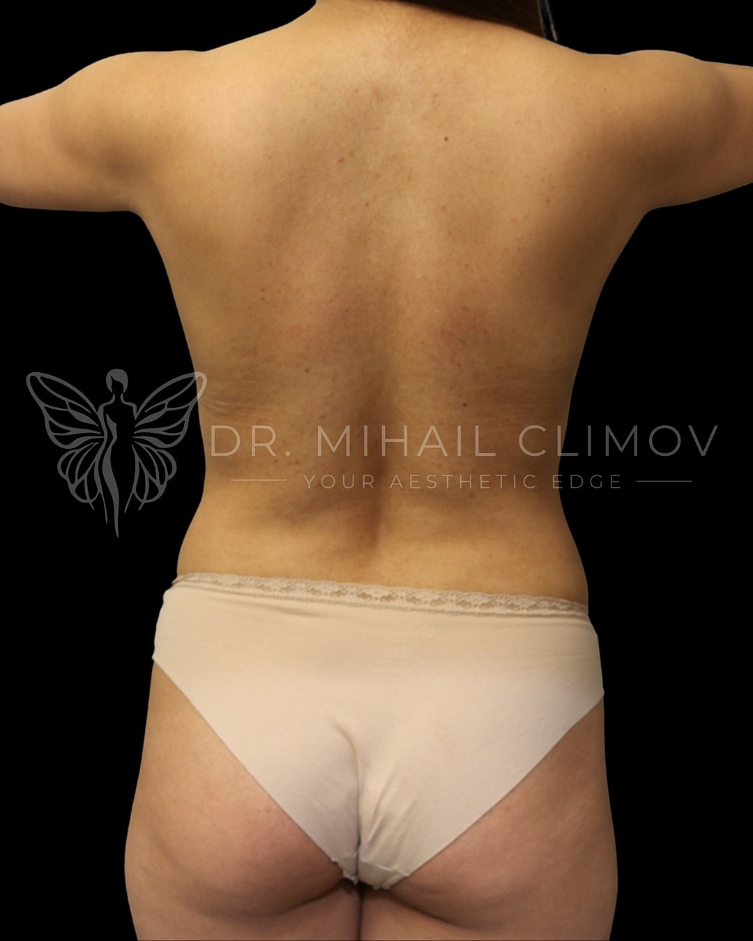 Back view of a woman in underwear.