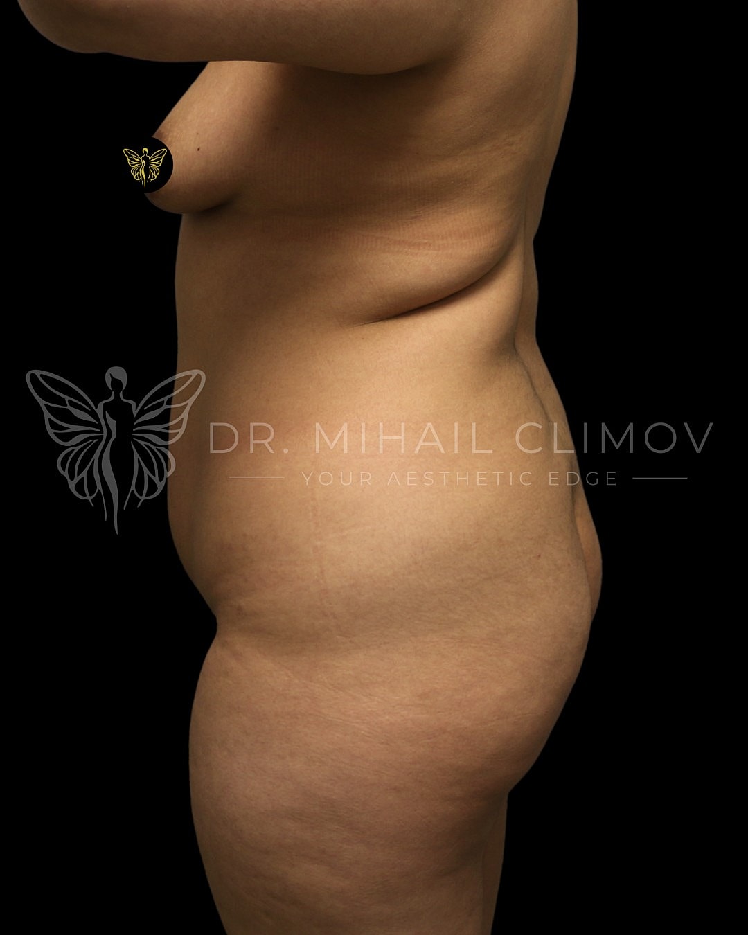 Profile of woman's torso against black background.