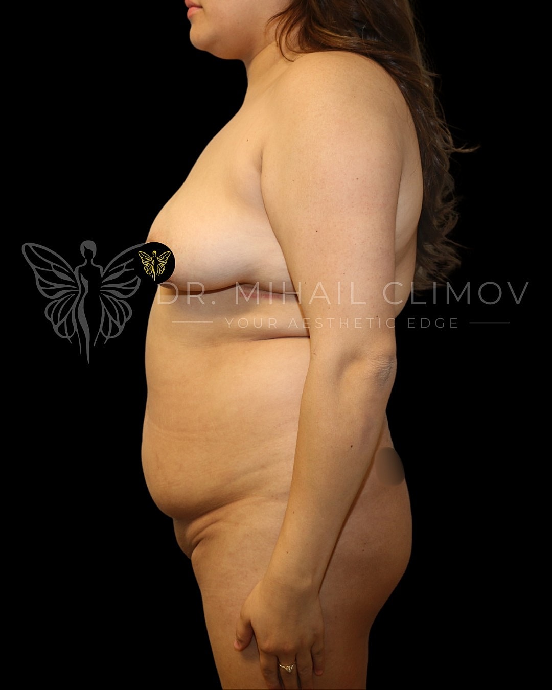 Side profile of a person in natural pose.