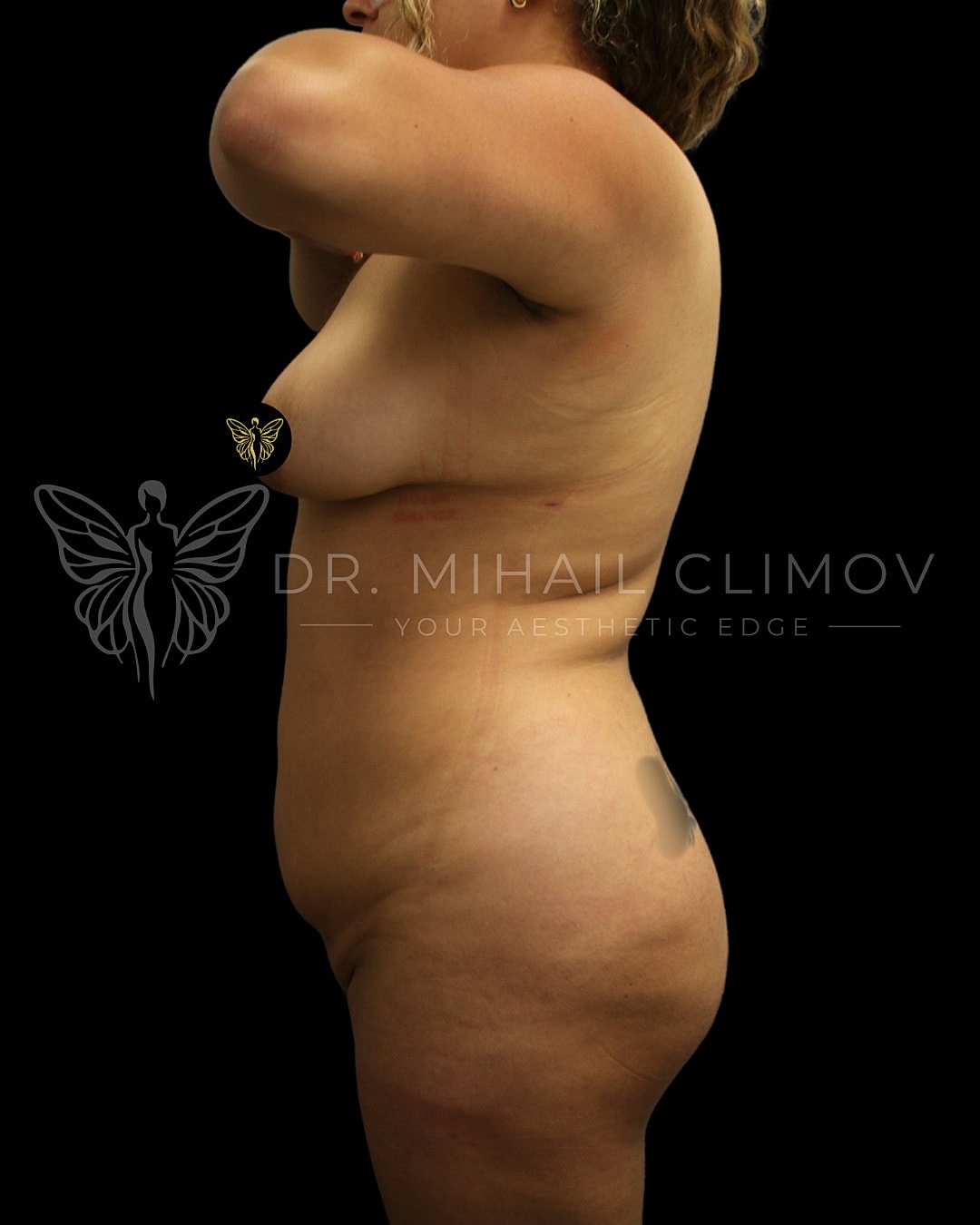 Profile view of woman adjusting clothing.