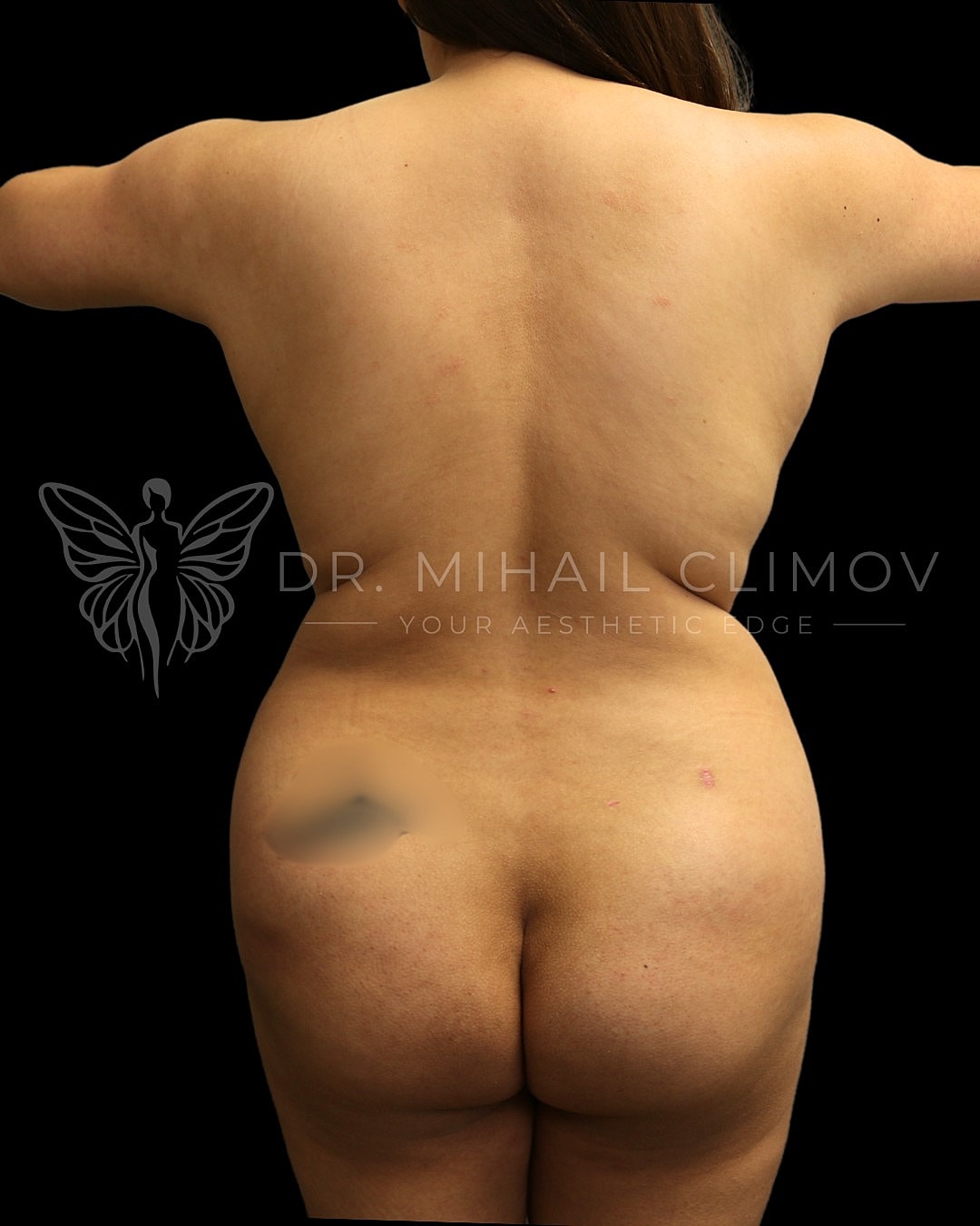 Back view of a person with arms extended.