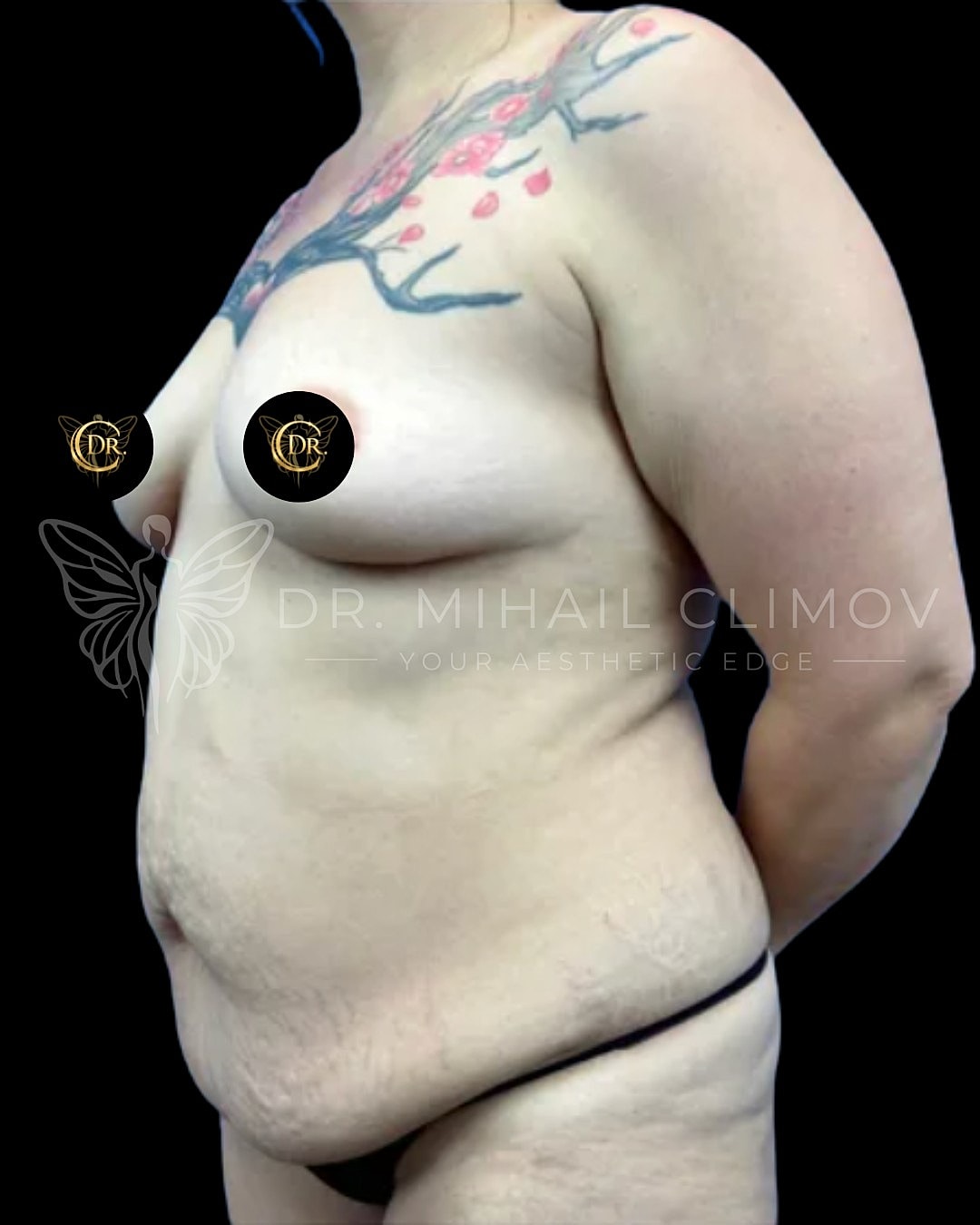 Side view of body with floral tattoo.