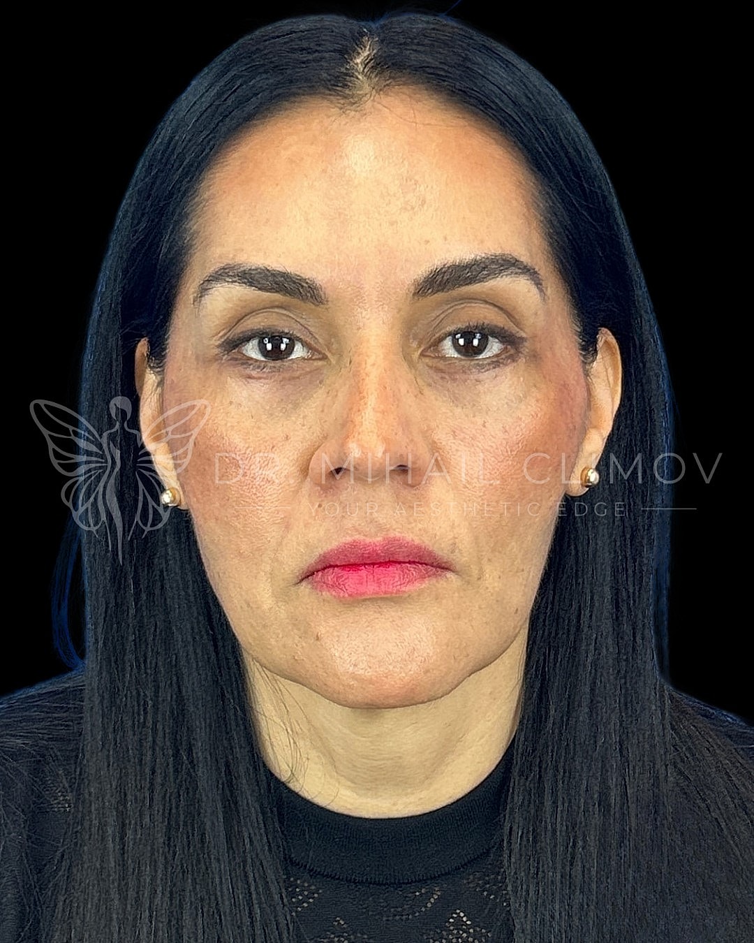 Facial close-up showcasing natural beauty and confidence.