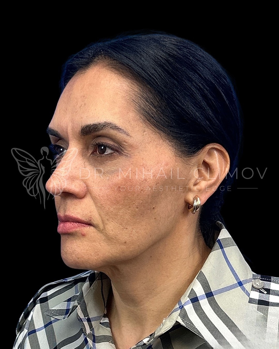Profile view of a woman in a checkered shirt.