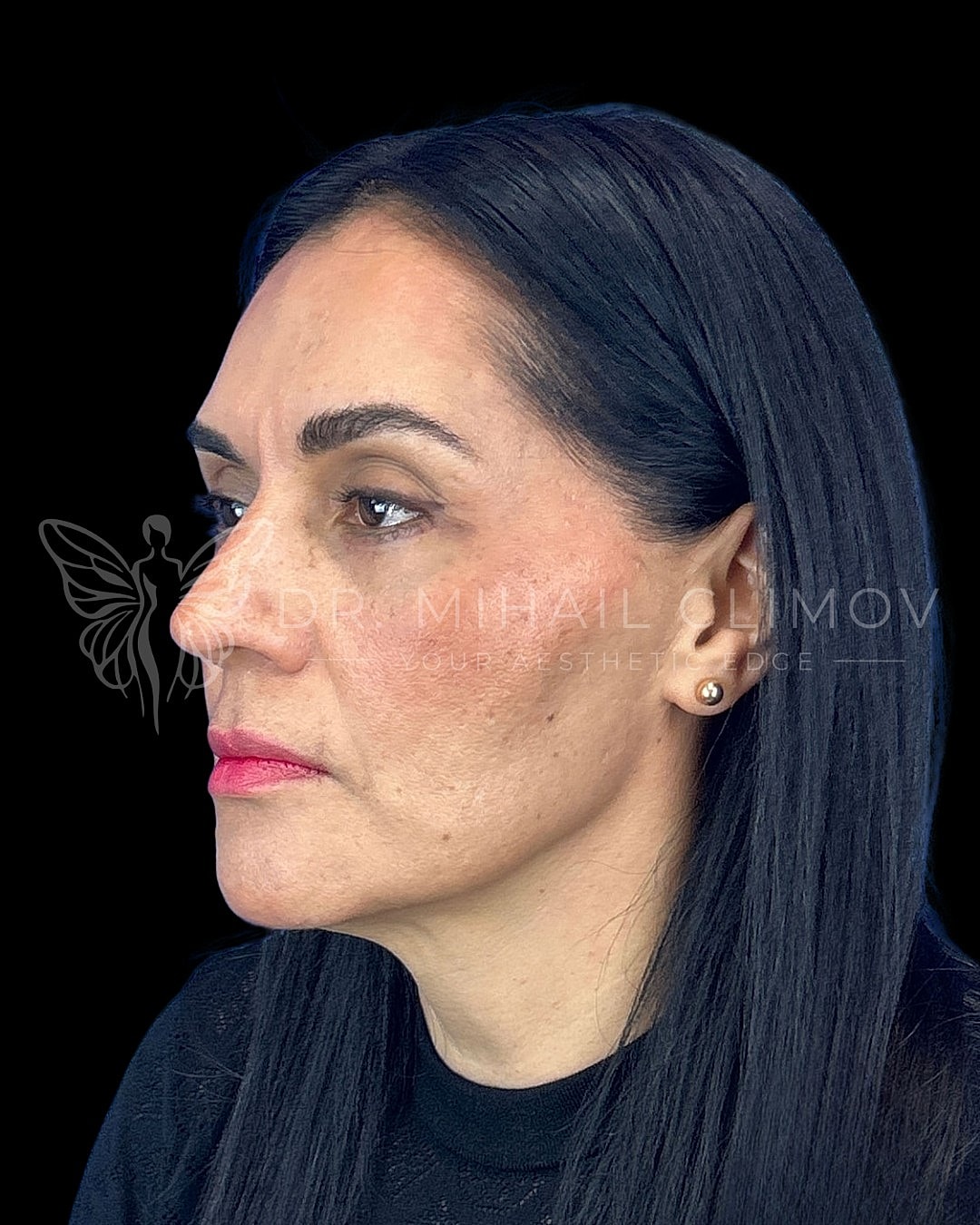 Profile view of woman with long black hair.