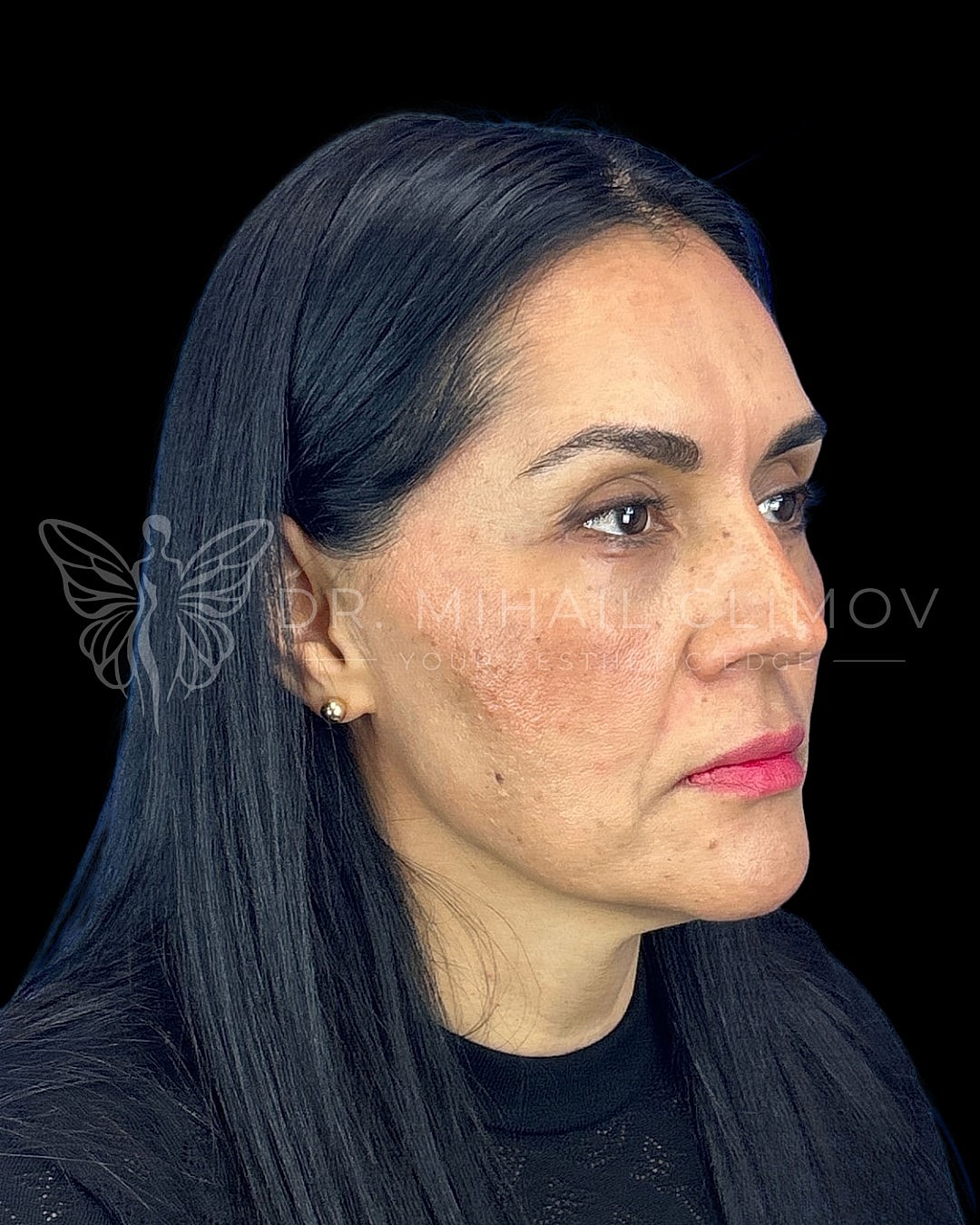 Profile view of a woman with dark hair