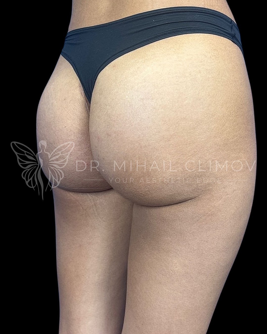 Model in thong underwear from behind, aesthetic focus.