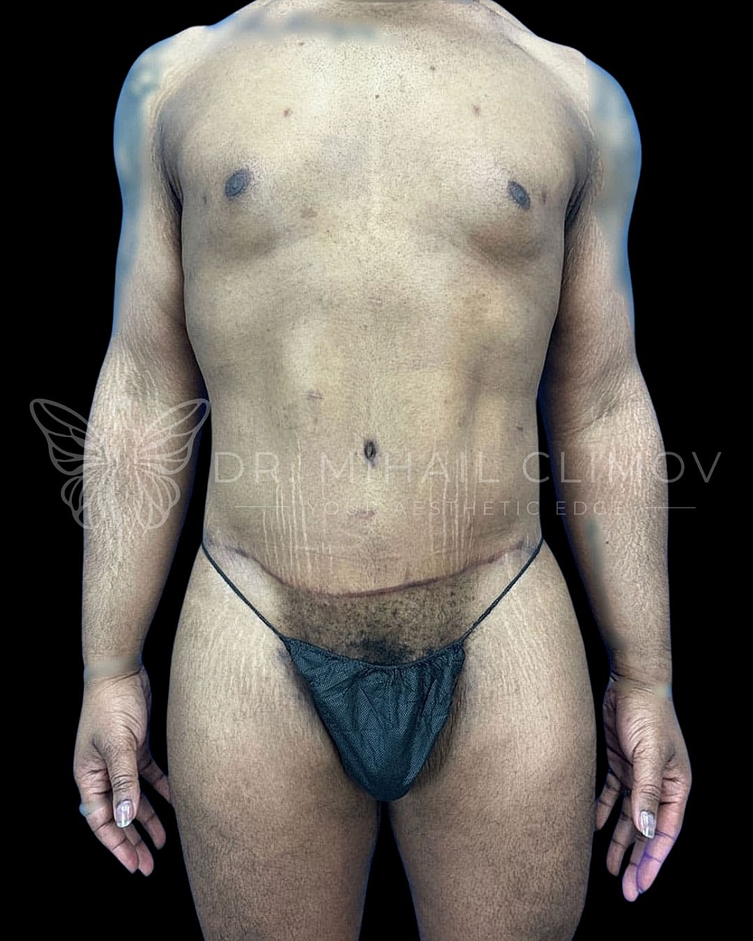 Male model posing in minimal clothing with smooth skin.