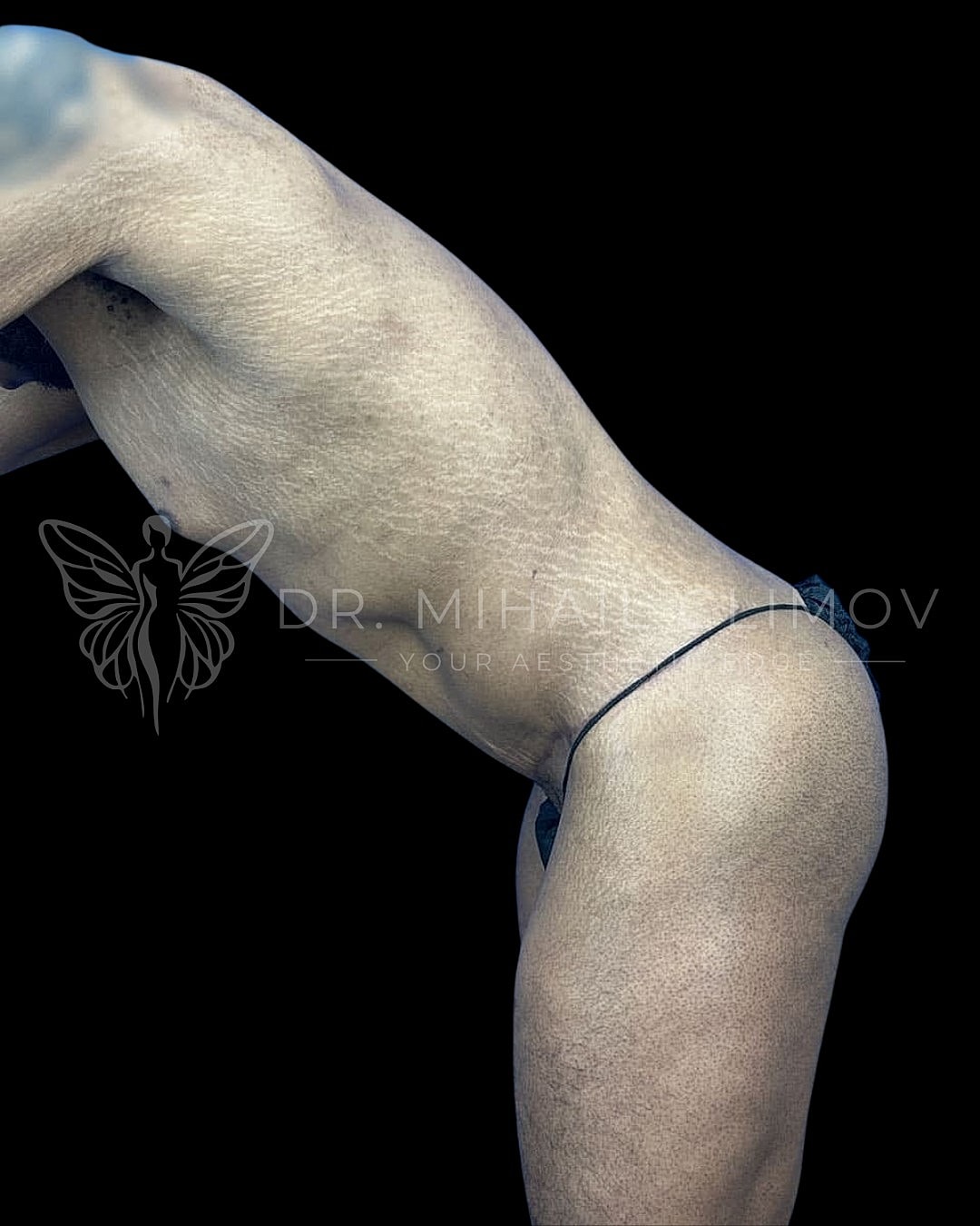 Profile view of a male body.