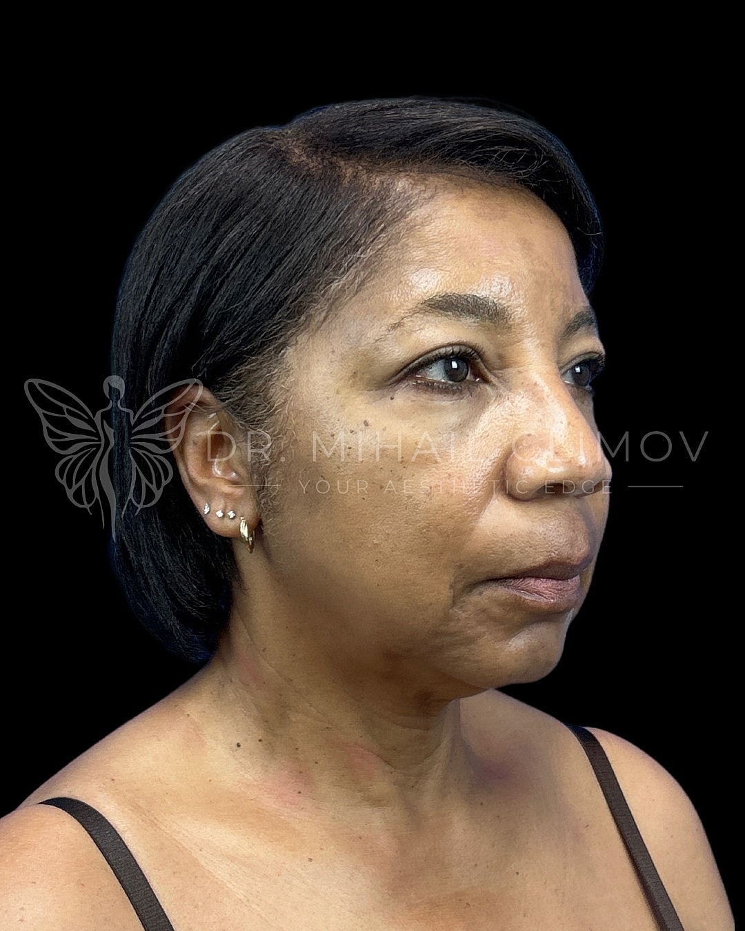 Woman with short hair, profile against black background.