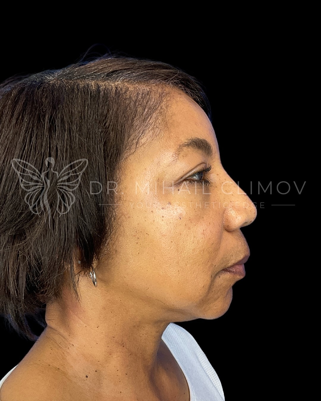 Profile view of a woman with short hair.