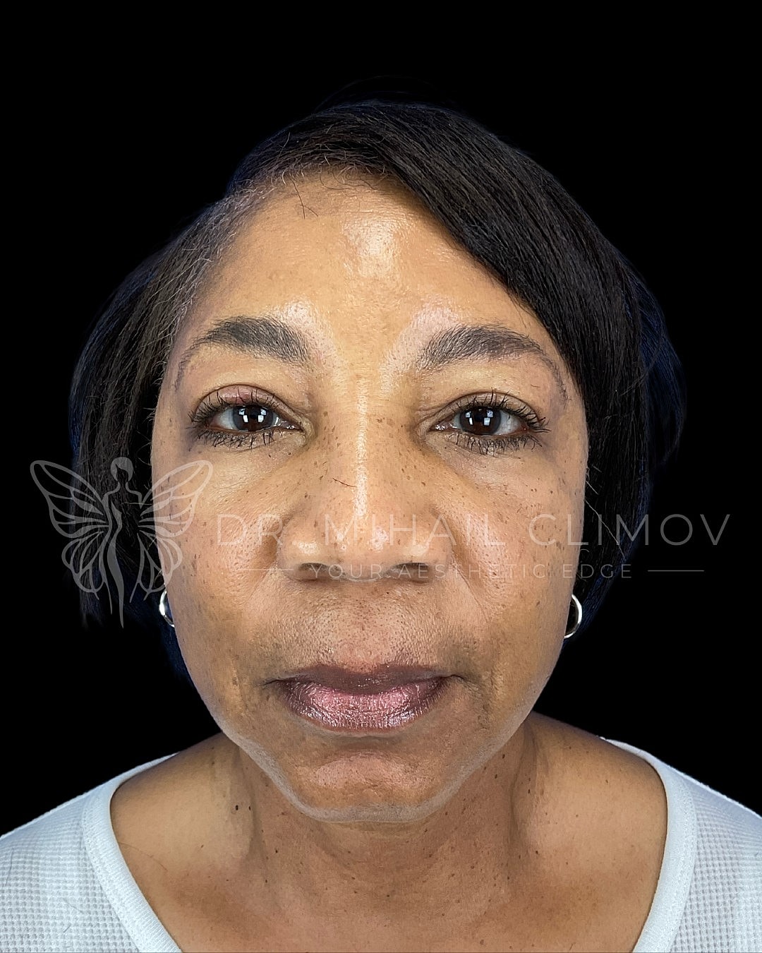 Close-up of a woman's face with natural lighting.
