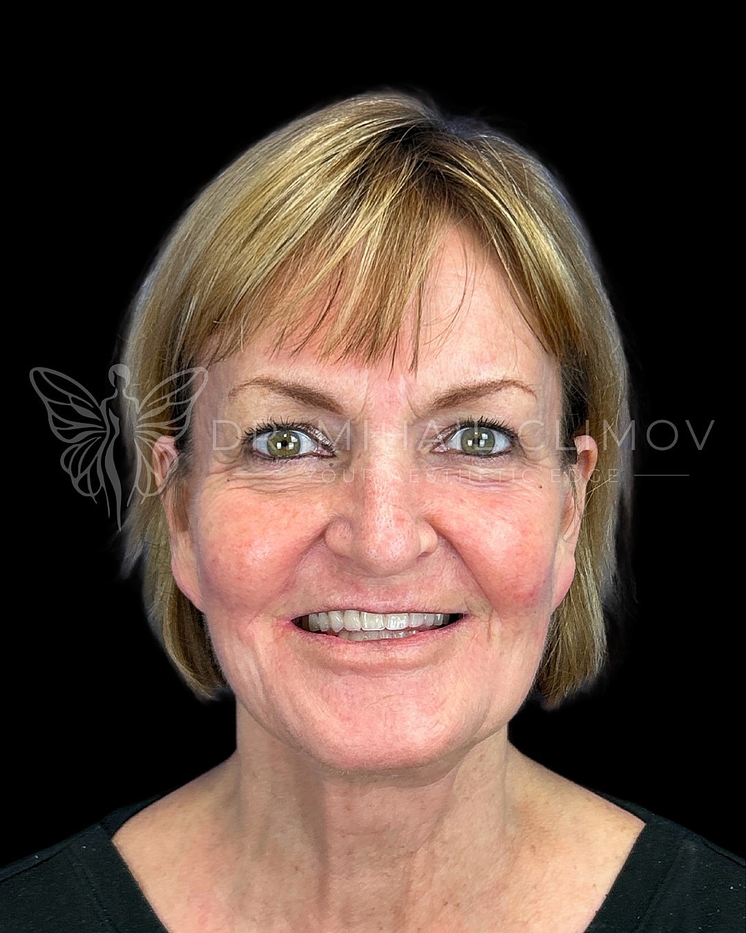 Smiling woman with short blonde hair and green eyes.