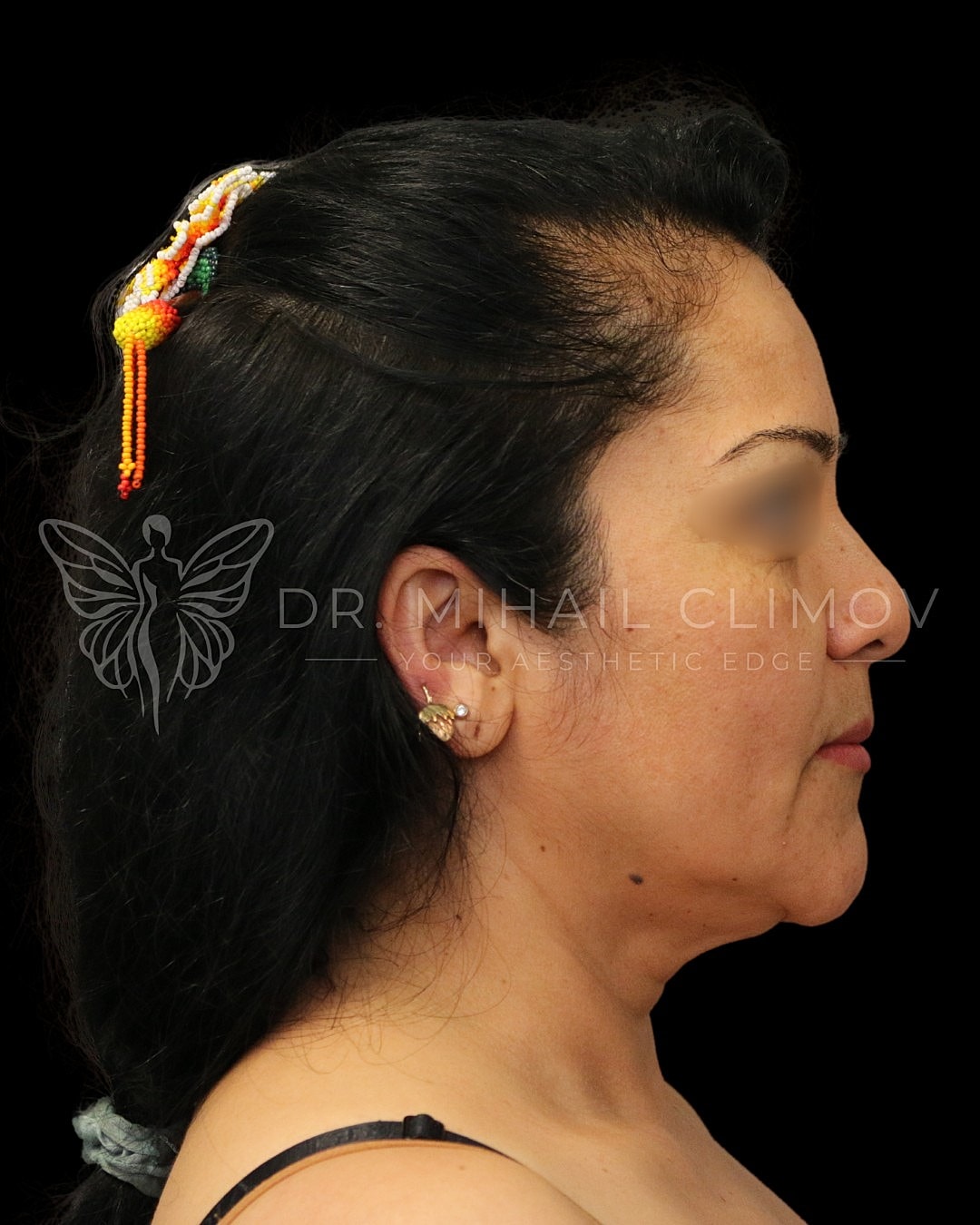 Profile view of woman with decorative hair accessory.
