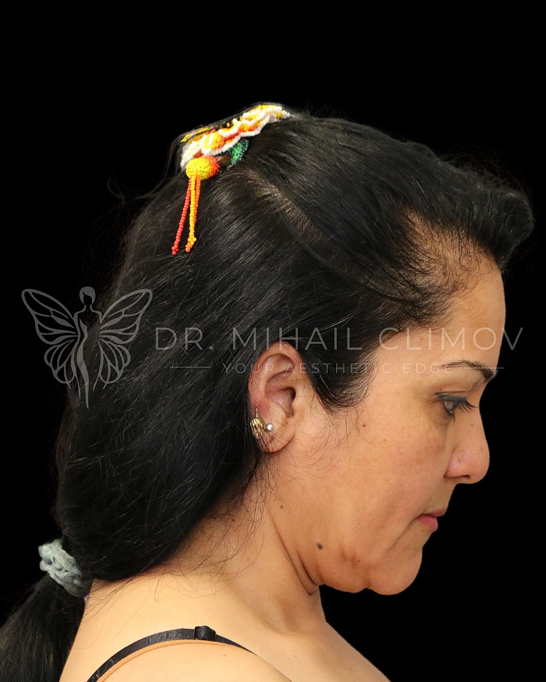 Woman with decorative hair clip, profile view.