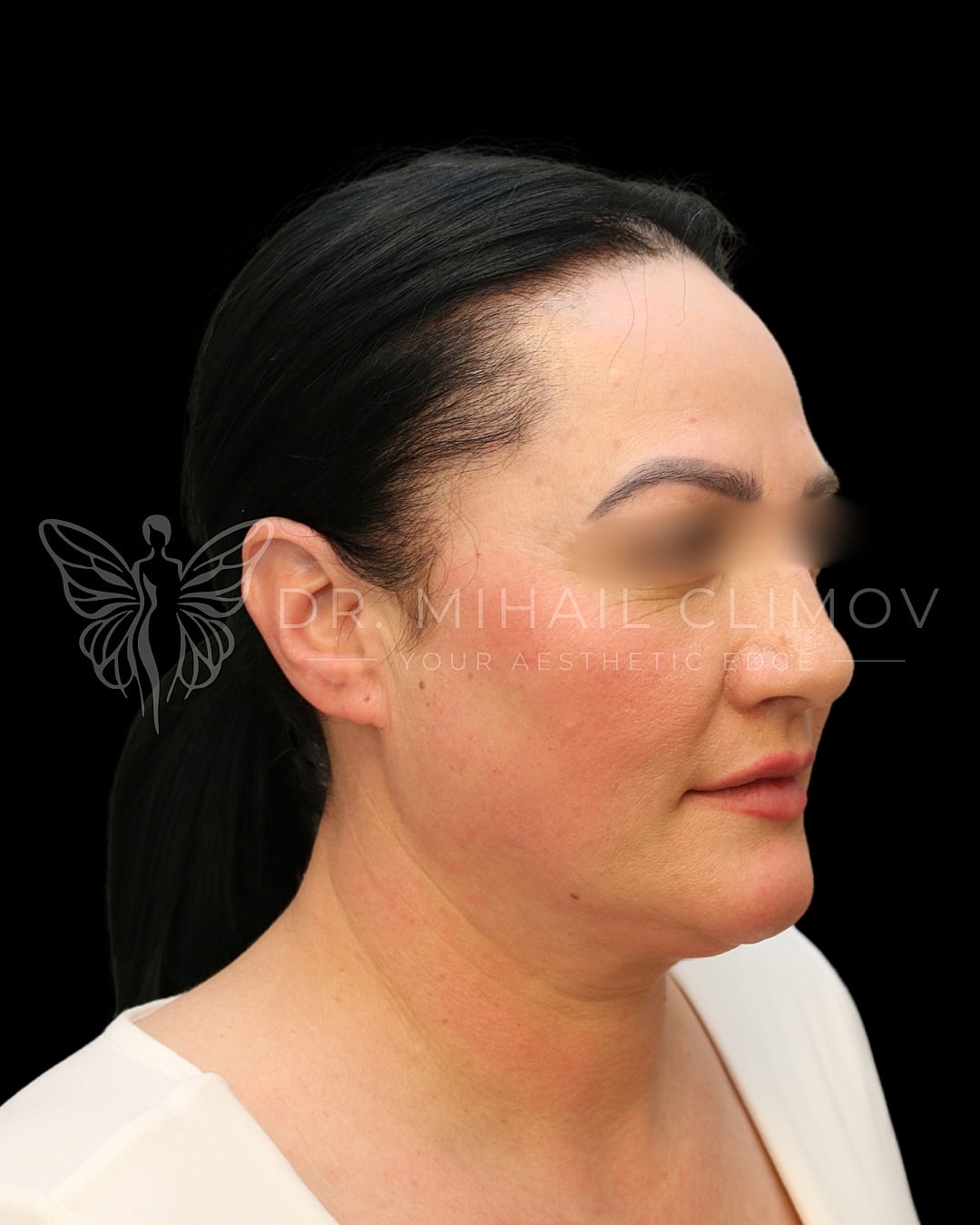 Profile view of a woman with smooth skin.