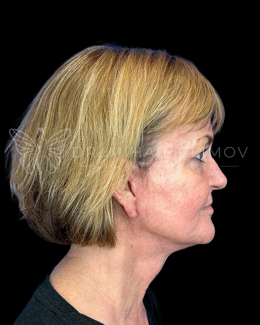 Profile view of a woman with blonde hair.