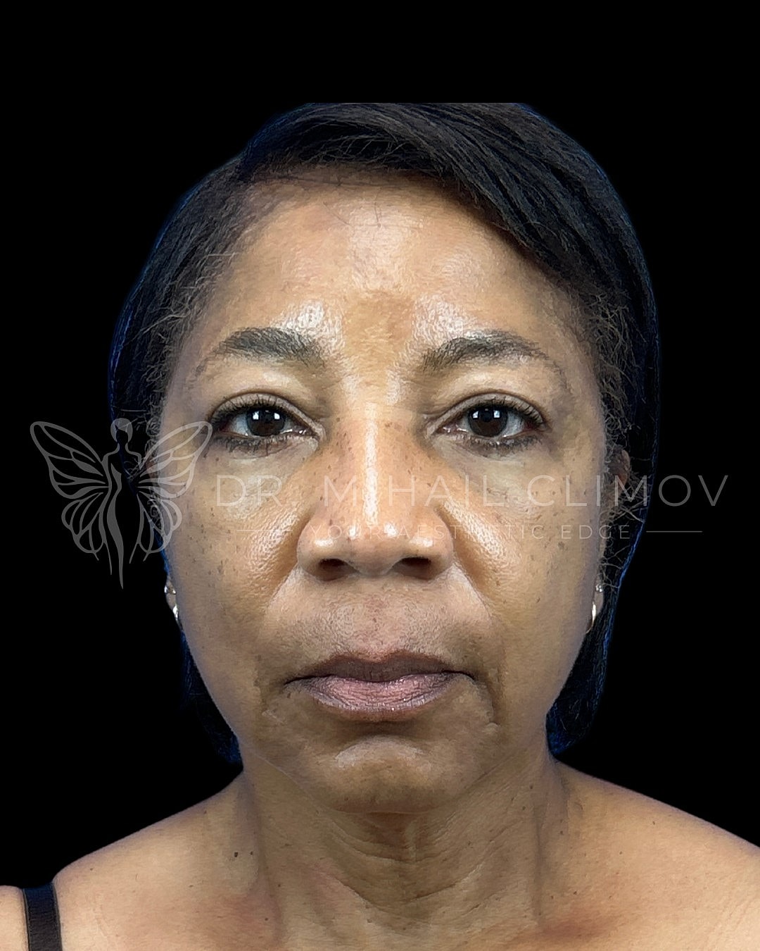 Portrait of a woman with natural skin tone.