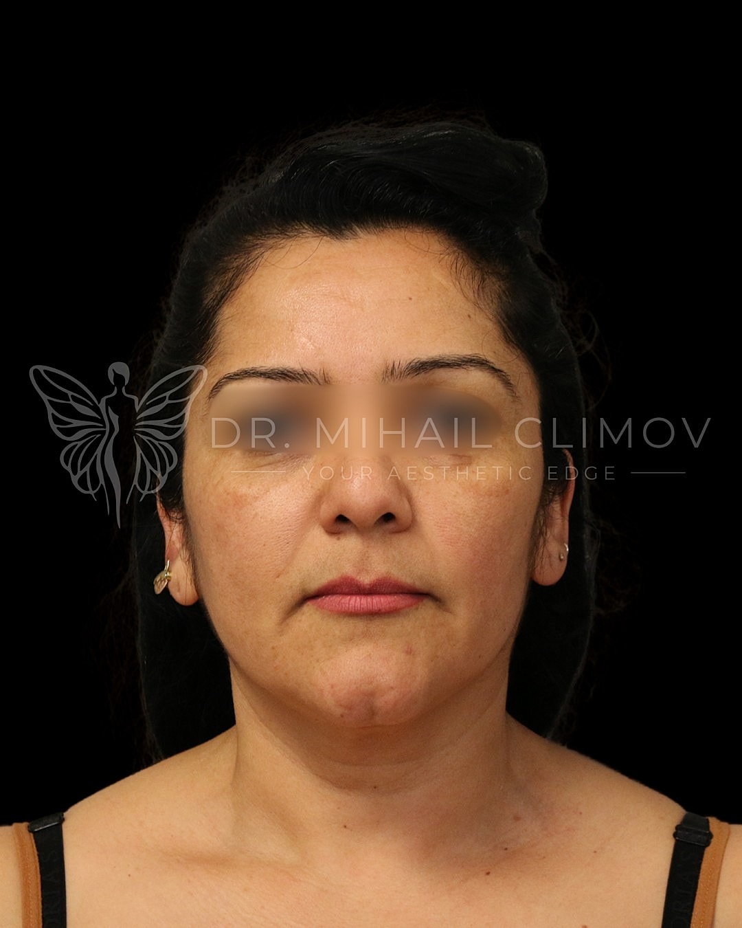 Portrait of a woman with a neutral expression.