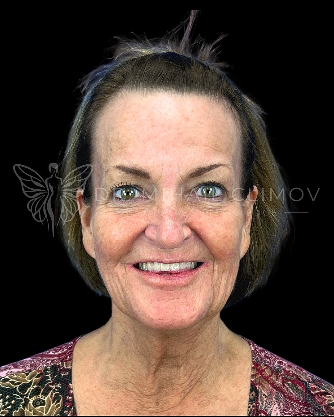 Smiling woman with short hair, black background.