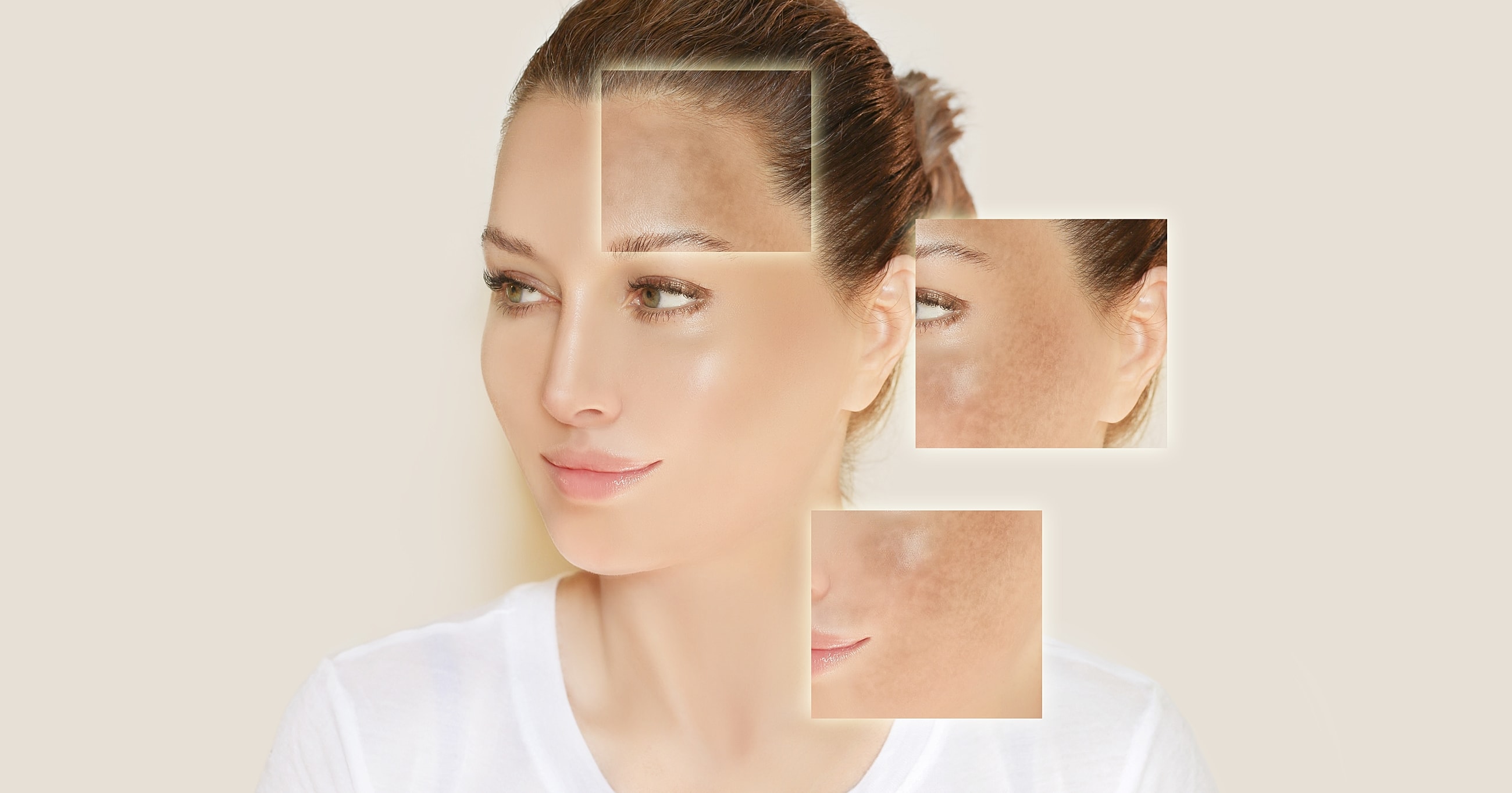 Sun damage and hyperpigmentation highlighted on a woman's face.